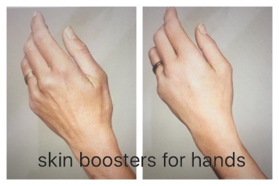 hands.jpg