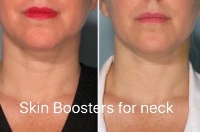 neck.jpg