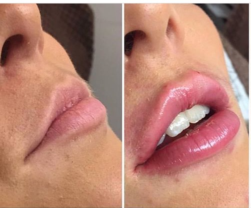 lips2.jpg