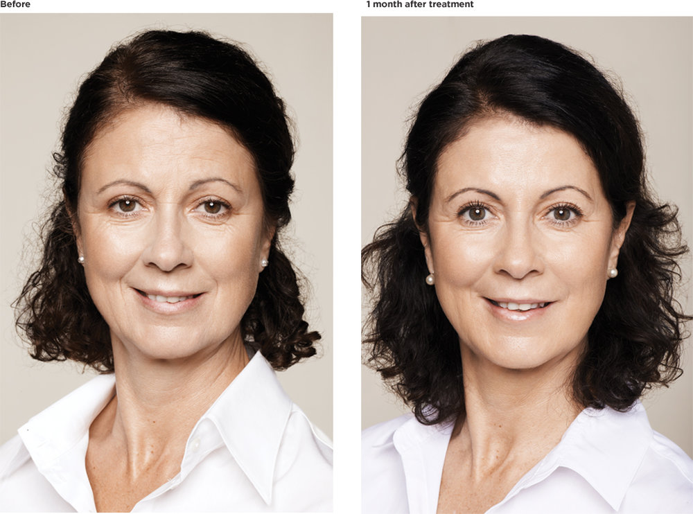Dolores,-age-55.jpg