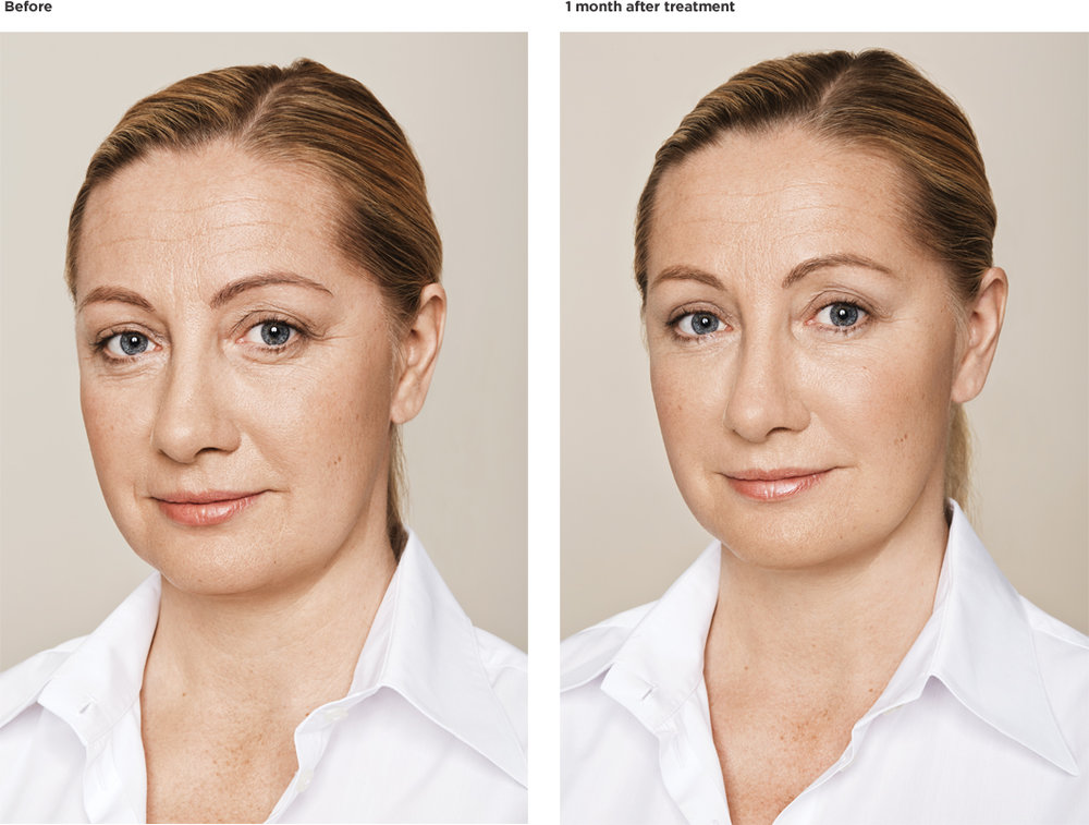 Birgitta,-age-42.jpg
